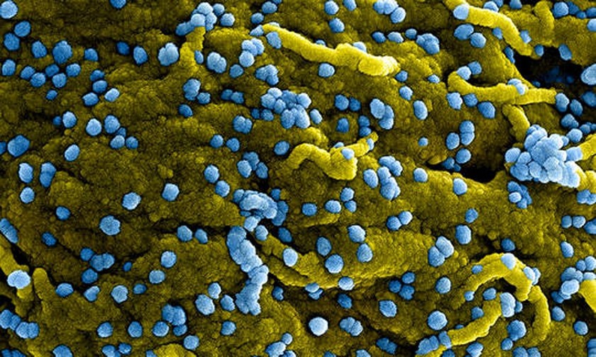 Các phần tử virus Marburg (màu xanh) nổi lên và bám chặt trên bề mặt tế bào nhiễm (màu vàng). Ảnh: SKĐS