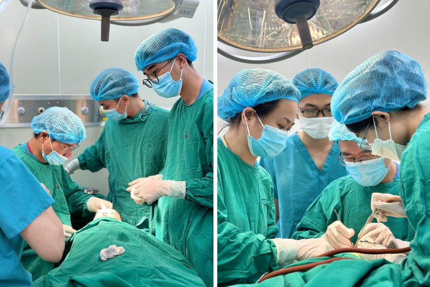Các bác sĩ tại Bệnh viện Hữu nghị Việt Nam - Cuba phẫu thuật miễn phí cho các bệnh nhân bị dị tật khe hở môi, hàm ếch...