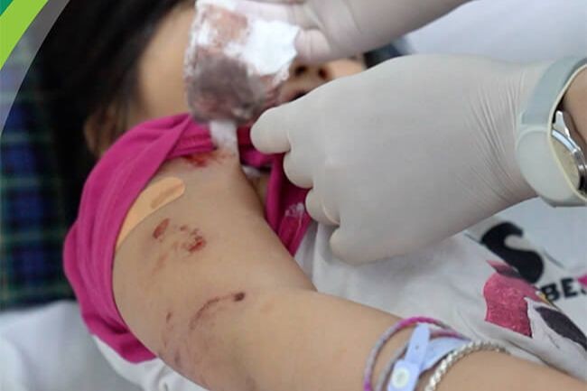 Bé gái H.A (5 tuổi, ở Hà Giang) bị chó cắn được cấp cứu tại Bệnh viện Nhi Trung ương. Ảnh: Bệnh viện Nhi Trung ương