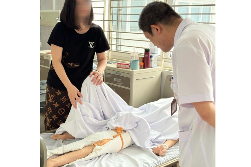 Bệnh nhân đang điều trị tại Bệnh viện Bệnh Nhiệt đới Trung ương. Ảnh: Bệnh viện cung cấp