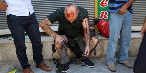 Một người bị thương trong vụ đánh bom ở Suruc Ảnh: Reuters