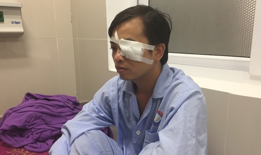 Bác sĩ Sơn bị đánh dẫn đến bị thương nặng ở mắt.
