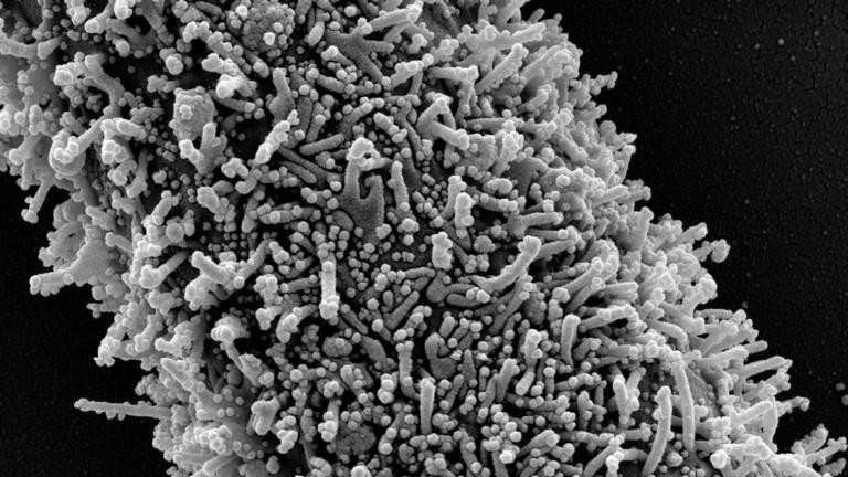 Một tế bào CCL-81 dài đơn lẻ bị nhiễm các phần tử virus SARS-CoV-2. Ảnh: Universal Images Group qua Getty Images