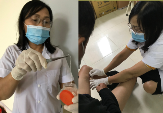 Bệnh nhân nhiễm giun rồng đến khám tại Trung tâm Kiểm soát bệnh tật tỉnh Yên Bái. Ảnh: Sở Y tế Yên Bái