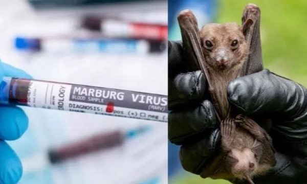 Virus Marburg là một trong sáu dòng họ của virus Ebola, nguy cơ tử vong lên đến 80%. (Ảnh: Internet)