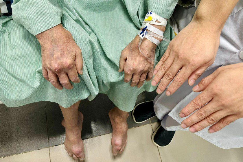 Lúc vào viện, bệnh nhân sưng đau ở các khớp tay, chân