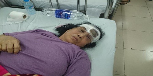 Bà Thoa đang điều trị tại bệnh viện