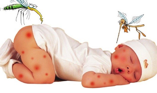 Xóa vết thâm do muỗi đốt cho trẻ vô cùng đơn giản