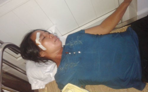 Nghệ An: Cán bộ lâm trường bị dân tố “đánh người”