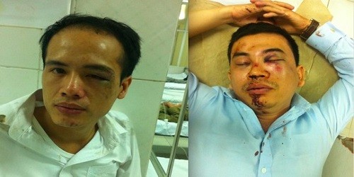 Liên đoàn Luật sư Việt Nam đề nghị khởi tố vụ 2 luật sư bị hành hung