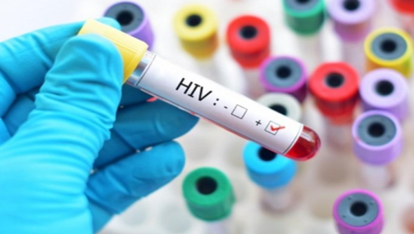 Trường hợp người nhiễm HIV không thể tự thông báo tình trạng nhiễm HIV thì được uỷ quyền bằng văn bản cho nhân viên y tế thông báo.