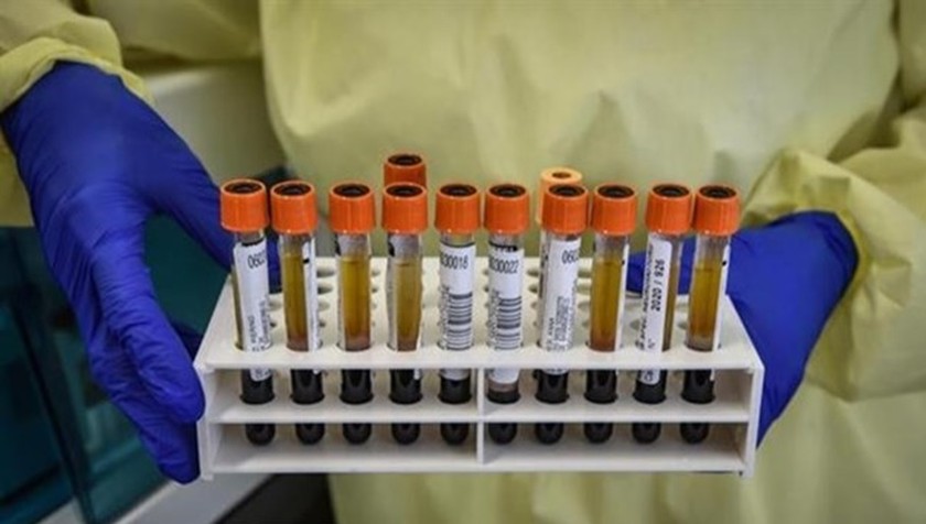 Các mẫu bệnh phẩm COVID-19 được sử dụng để nghiên cứu vắcxin phòng ngừa dịch tại bệnh viện Spallanzani ở Rome, Italy. (Nguồn: ANSA/TTXVN)
