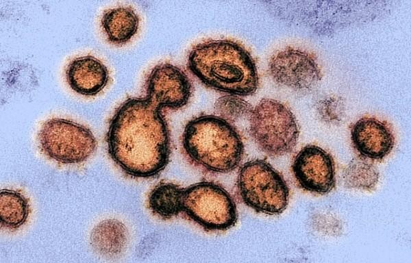 Phát hiện mẫu virus SARS-CoV-2 đầu tiên bị xóa khỏi cơ sở dữ liệu của Viện Y tế Quốc gia Mỹ