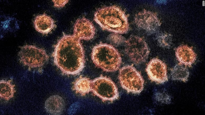 SARS-CoV-2 - loại virus gây ra đại dịch COVID-19. 