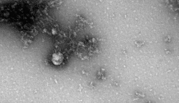 Hình ảnh hiển vi của biến thể virus SARS-CoV-2 mới. Ảnh: Rospotrebnadzor.