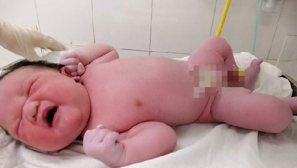 Bé trai chào đời với trọng lượng “khủng” lên tới 5,39 kg.  (Ảnh: BVCC)