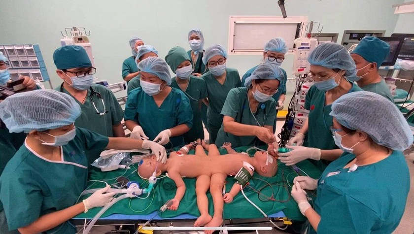 Chào mừng đến với hình ảnh ca phẫu thuật tách rời cặp song sinh, với tỷ lệ thành công rất cao trong nhiều trường hợp, các bác sĩ sẽ cho bạn thấy những kết quả ấn tượng khi thực hiện ca phẫu thuật tách rời cặp song sinh.