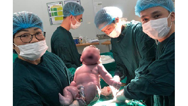 Bé trai nặng 5,75kg là một trong những em bé có cân nặng hiếm gặp tại Bệnh viện Bệnh Nhiệt đới Trung ương. Ảnh: Thanh Đặng