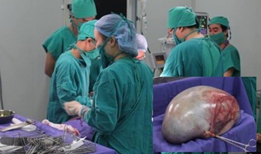 Bệnh viện Sản nhi Quảng Ninh  phẫu thuật thành công khối u hơn 6kg