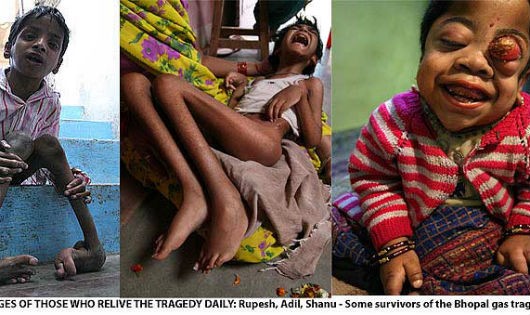Thế hệ sau bị dị tật vì bố mẹ bị phơi nhiễm chất độc do thảm kịch Bhopal gây nên.