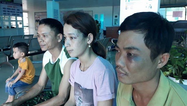 Ba người bị nhóm côn đồ đánh đều phải nhập viện để điều trị.