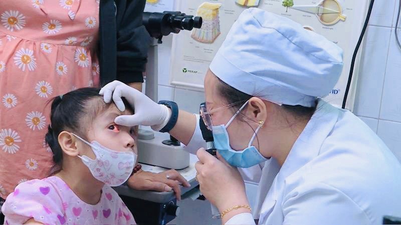  Trẻ bị đau mắt đỏ tăng nhanh tại Đồng Nai
