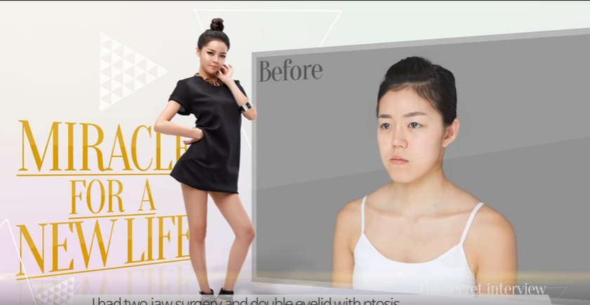 Kim Min Hee trước và sau phẫu thuật thẩm mỹ.