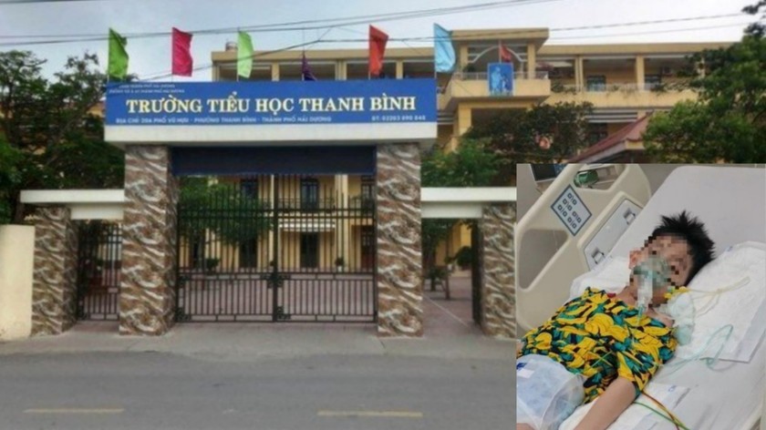 Ngày 18/4/2023, cháu Nguyễn Sơn Tùng đã gặp tai nạn ngay trong khuôn viên Trường tiểu học Thanh Bình, TP Hải Dương.