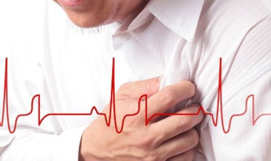 Sau nhồi máu cơ tim cần kiêng gì?