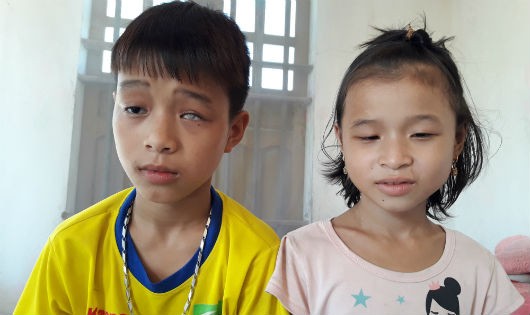Hai anh em Văn và Ly đều bị chứng bệnh trầm trọng về mắt